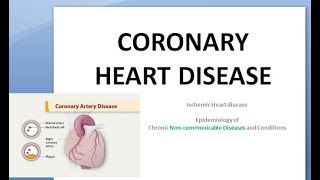 PSM 385 Coronary heart disease CHD Ischemic Monica Prudent Diet