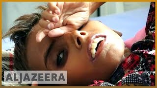 🇾🇪As Saudi-coalition expands Yemen war, UN says famine accelerating l Al Jazeera English