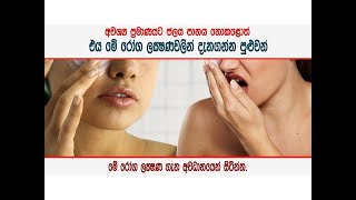 මෙන්න මේ රෝග ලක්ෂණ තිබෙනවා නම් - Drink more water if you have these symptoms