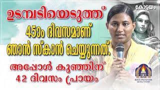 ഉടമ്പടിയെടുത്ത് 45-ാം ദിവസമാണ് ഞാൻ സ്കാൻ ചെയ്യുന്നത്.അപ്പോൾ കുഞ്ഞിന് 42 ദിവസം പ്രായം.