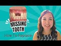 🦷 Step-by-Step Guide to Managing Tooth Loss 🦷