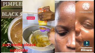 yino Engeri jetukolamu sabuni wembalabe ewaka(how to make pimple soap at home simple