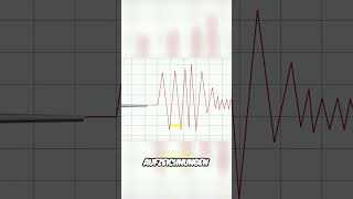 Der Seismograph: Unser Schlüssel zum Verständnis von Erdbeben