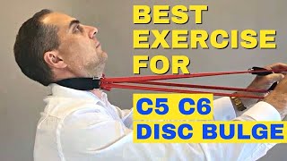 Best Exercises For C5 C6 Bulging Disc | C5 C6 Herniated Disc Exercises by Dr. Walter Salubro