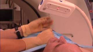 New Device for Lung  Biopsy-Mayo Clinic