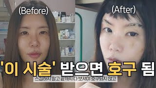 의사들은 절대 안 하는 피부과 호구되는 시술 4가지! 가성비\u0026 가심비 갑 시술4가지! 피부과 20년 VVIP 추천 시술 vs 비추천!