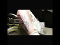 laser tattoo removal at las vegas dermatology the girl with the dragon tattoo