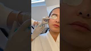 Skinvive by Juvederm with Dr. Annie Chiu at The Derm Institute