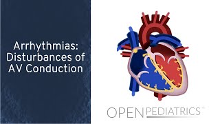 Arrhythmias: Disturbances of AV Conduction by C. LaGrasta | OPENPediatrics