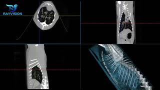 Veterinary CT Animal CT Cat 6kg Compensatory Pulmonary Emphysema