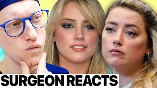 Did Amber Heard have Cheek Implants? | Plastic Surgeon Reacts