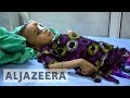 Seven million in Yemen face threat of famine