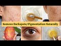 Try this Homemade Facial to remove Hyperpigmentation/Melasma/Darkspots & Darkcircles In Just 7 Days✅