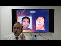 Acute otitis externa (Malayalam) Patient teaching programme