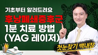 백내장 수술 후 생긴 후낭폐쇄증후군 환자의 1분 치료 방법(YAG 레이저)