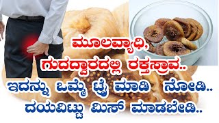 ಮೂಲವ್ಯಾಧಿ,ಗುದದ್ವಾರದಲ್ಲಿ ರಕ್ತಸ್ರಾವ|ಇದನ್ನು ಒಮ್ಮೆ ಟ್ರೈಮಾಡಿ  ನೋಡಿ|  ದಯವಿಟ್ಟು ಮಿಸ್ ಮಾಡಬೇಡಿ..! home remedy