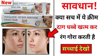 Roop Sundari Gold Cream Review | how to use roop sundari night cream