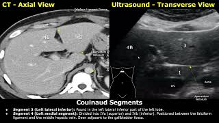 Couinaud Classification of Liver Segments On Ultrasound \u0026 CT Scan | Liver Anatomy USG Probe Position