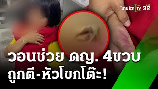 วอนช่วยดญ.4ขวบ ถูกตี-หัวโขกโต๊ะ | 2  ส.ค. 67  | ข่าวเช้าหัวเขียว