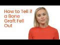 how to tell if a bone graft fell out