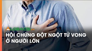 Hội chứng đột ngột tử vong ở người lớn