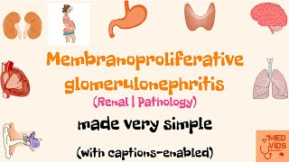 Membranoproliferative glomerulonephritis | MPGN | Renal system | Pathology | Med Vids made simple