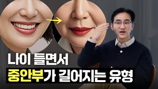 #중안면 혹시 얼굴이 점점 길어지고 있나요?