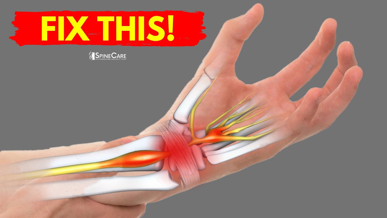 How To Fix Wrist Pain Richeffective24