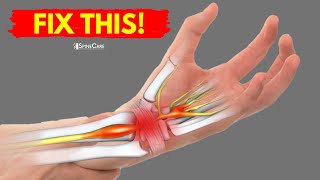 How to Fix Wrist Pain for Good