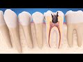 history of the american association of endodontists