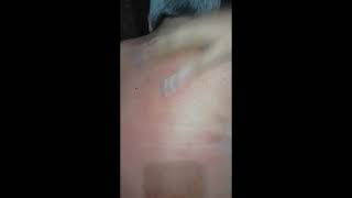 Back Scratcher Read Video Description