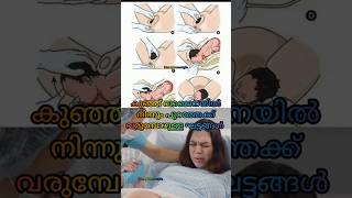 Stages of labor🤱🤱പ്രസവ സമയത്ത് കുഞ്ഞ് പുറത്തേക്ക് വരുമ്പോൾ🤱#youtube #pregnancy #baby #shorts #short