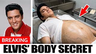 What Made Elvis Presley's Organs Grow to TWICE Their Size – His Final 24 Hours Will TERRIFY You!