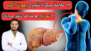 ١٢ علامة تخبرك بتلف وموت الكبد 🫣و٤ تحاليل قد تنقذ حياتك🩻