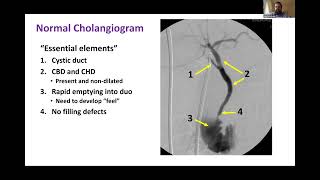 SAGES Laparoscopic Common Bile Duct Exploration: State of the Art - May 16, 2023