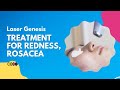 Laser Genesis | Treatment for Redness, Rosacea | West Hollywood, CA | Dr. Jason Emer