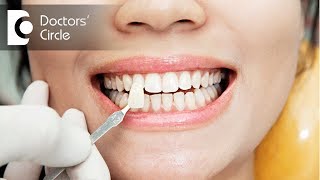 Veneers Vs Dental implants -Dr. Arundati Krishnaraj