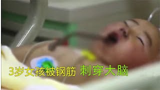 3歲女孩口中插入鋼筋，刺穿整個大腦，生命危在旦夕 #纪实 #醫療紀錄片 #生命緣 #醫院 #紀錄片