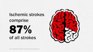 Enhanced FAST ED Stroke Assessment