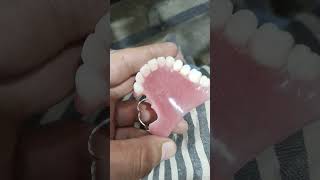 Upper Removable Partial Denture By Haider 😁😁😁#rpddentalprocedure