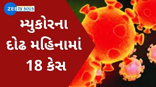 COVID-19: Mucormycosis cases on the rise in Gujarat again | Zee News