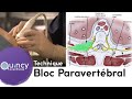 Bloc Paravertébral - Quincy Anesthésie