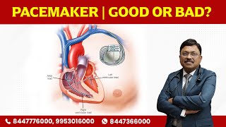 Pacemaker | Good or Bad? | Dr. Bimal Chhajer | Saaol