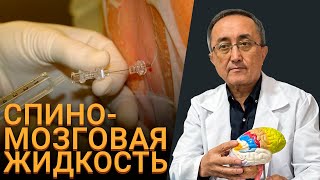 Спиномозговая Жидкость в Норме и Патологии | Ликвор | Лекция по Неврологии 2024