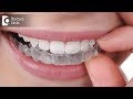 What is orthodontics and how is it treated ? - Dr. Ramesh N