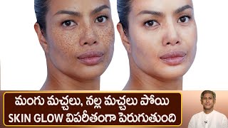 How to Get Rid of Pigmentation | Remedy for Pimples | Glowing Skin | Dr.Manthena's Health Tips