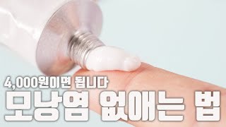 모낭염 연고 하나면 끝입니다. 제발 다른거 하지 마세요.