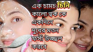 মাত্র 5মিনিট ব্যবহারেই ত্বকের কালো দাগ তুলে দুধের মতন ফর্সা উজ্জ্বল ত্বক|face whitening facial