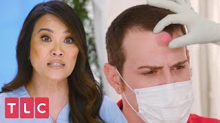 Squeezing a Cyst Off a Patient's Forehead | Dr. Pimple Popper