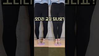 오다리는 교정이 될까요? 너무 신기합니다